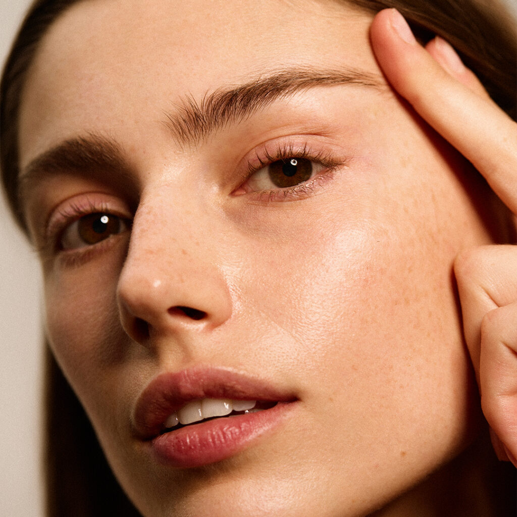 Gesicht einer Frau nach dem Augenbrauenlifting ohne OP bei Dr. Garving