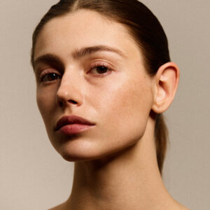 Gesicht einer Frau nach der Eigenblutbehandlung mit PRP