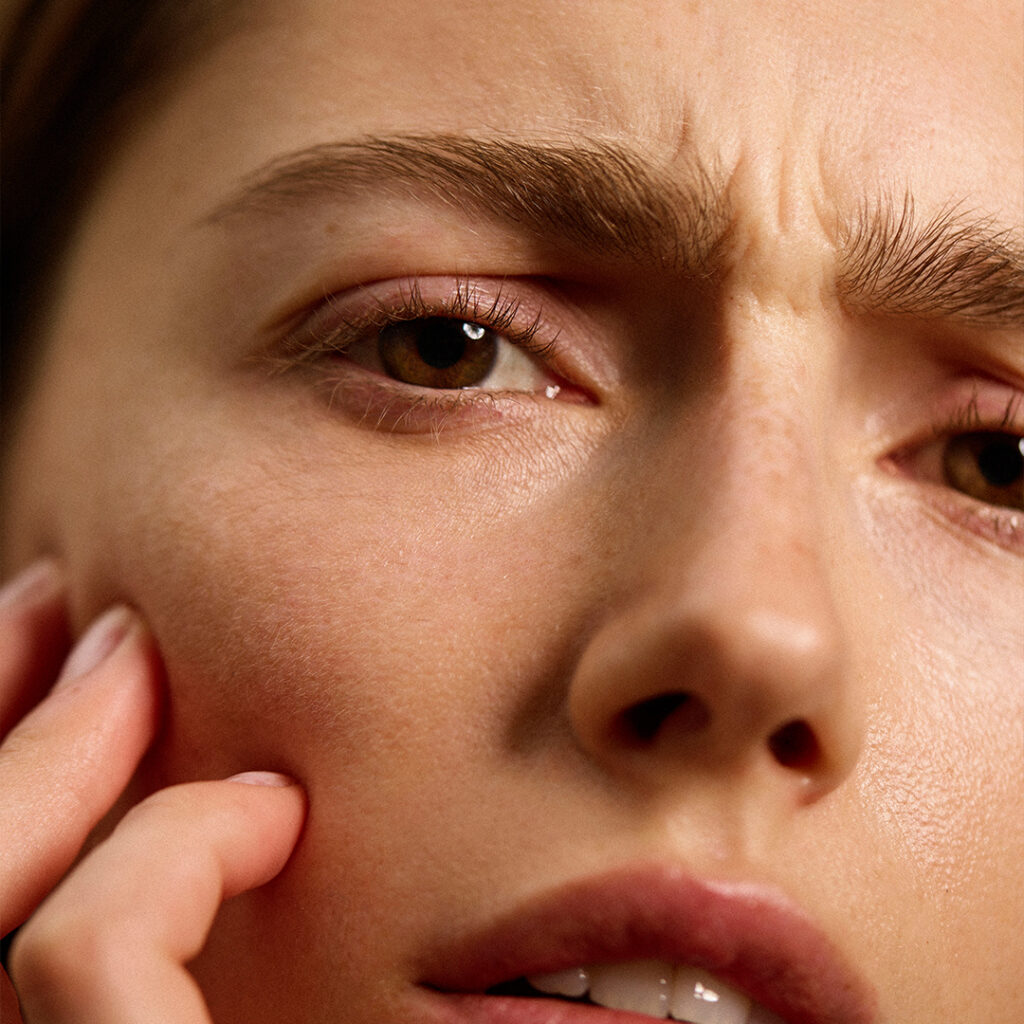 Frau mit angespannter Mimik und sichtbarer Falte zwischen den Augenbrauen – typische Zornesfalte durch Muskelaktivität